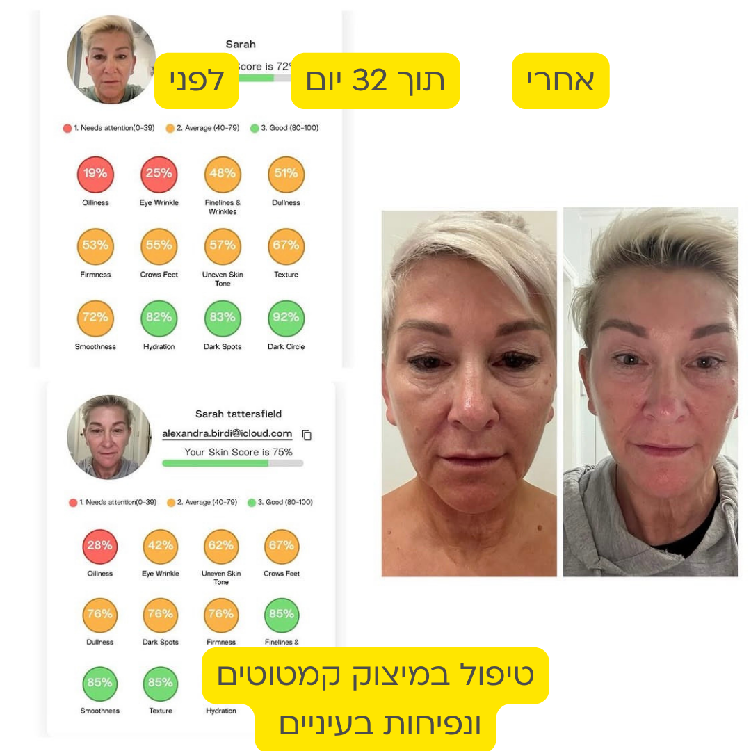 לפני אחרי 13