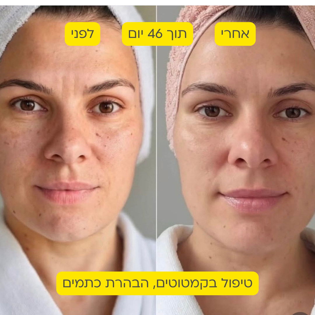 לפני אחרי 14