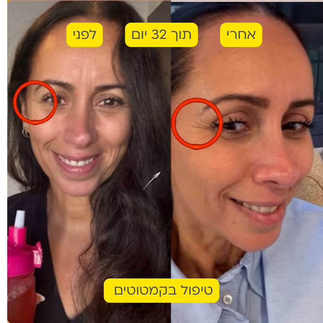לפני אחרי 19