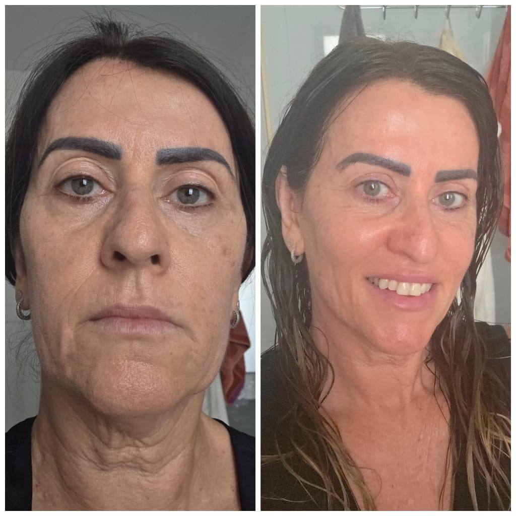 תוצאות לקוחה 6